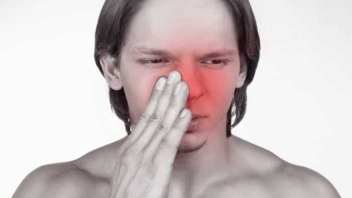 Mengatasi Gejala Sinusitis