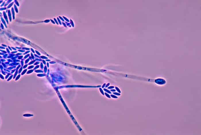 Penyakit Fusarium Pokkahbung Penyakit Fusarium Pokkahbung